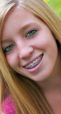 smiling teenage girl with braces